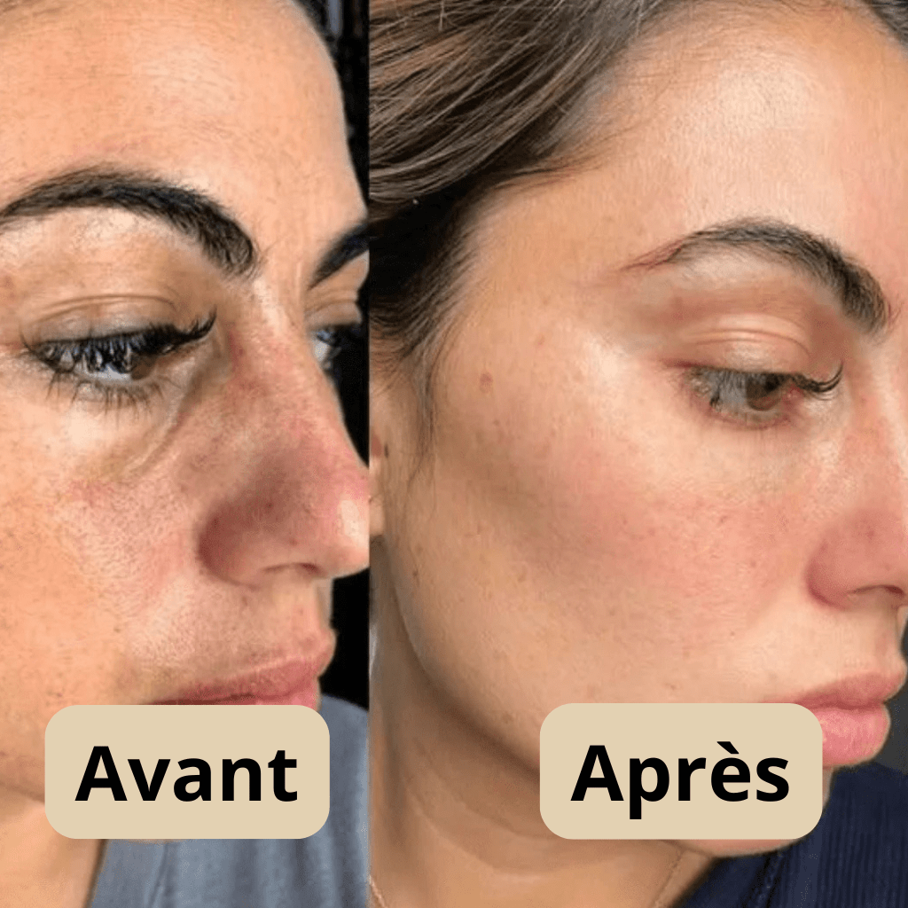 Peel Shot — Exfoliant
