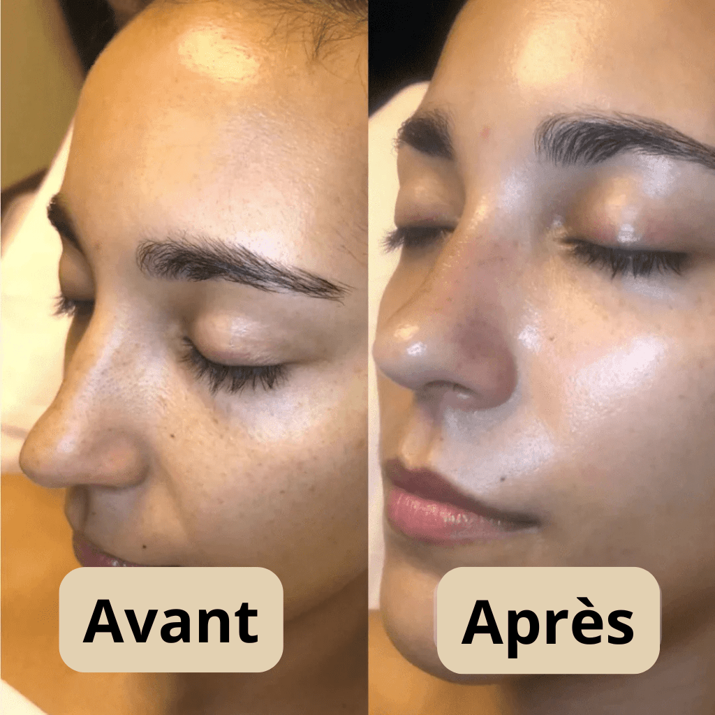 Peel Shot — Exfoliant